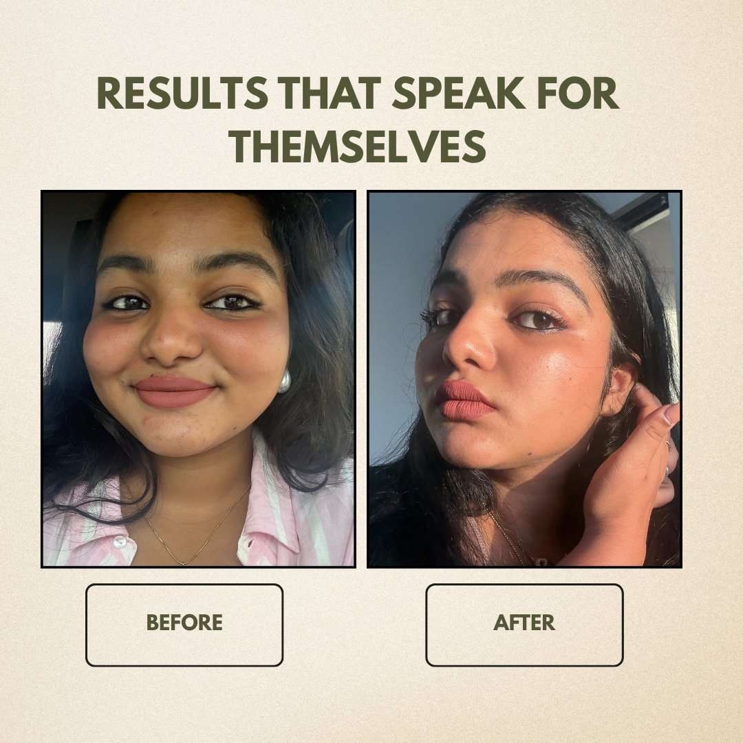 2022/02/1000599196.jpg 1000599196 Mystical Genesis Ayurveda