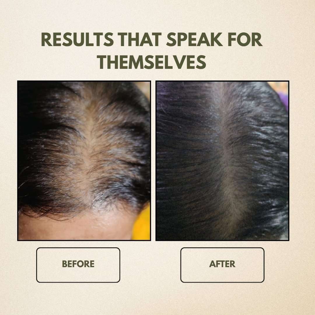 2022/03/1000599204.jpg 1000599204 Mystical Genesis Ayurveda