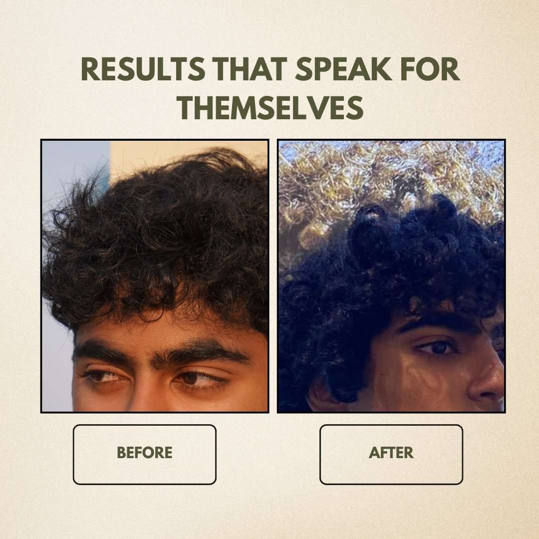 2022/03/1000599205.jpg 1000599205 Mystical Genesis Ayurveda