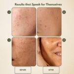 Foaming Face Wash: Juniper Berry (detoxifying and skin reviving) - Image 4