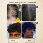 Bhringaraj Hair Oil - Image 4